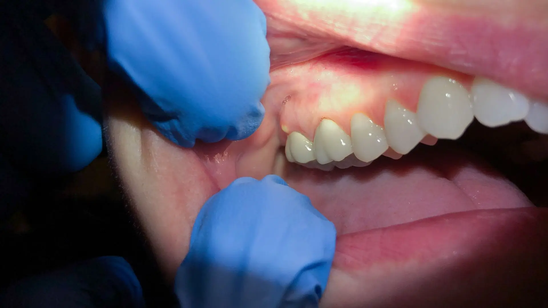 m38638 hero understanding what constitutes a dental emergency